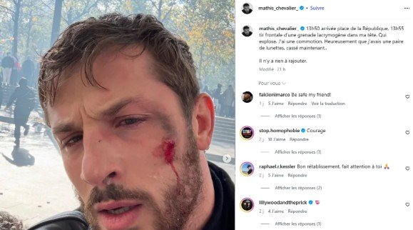 Mathis Chevalier, combattant de « L’Arène », victime d’une commotion après un tir de grenade lacrymogène place de la République le 17 Octobre